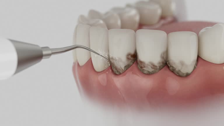 Trusted Teeth Cleaning And Checkup service in Leonville, LA - Dentist Open Now